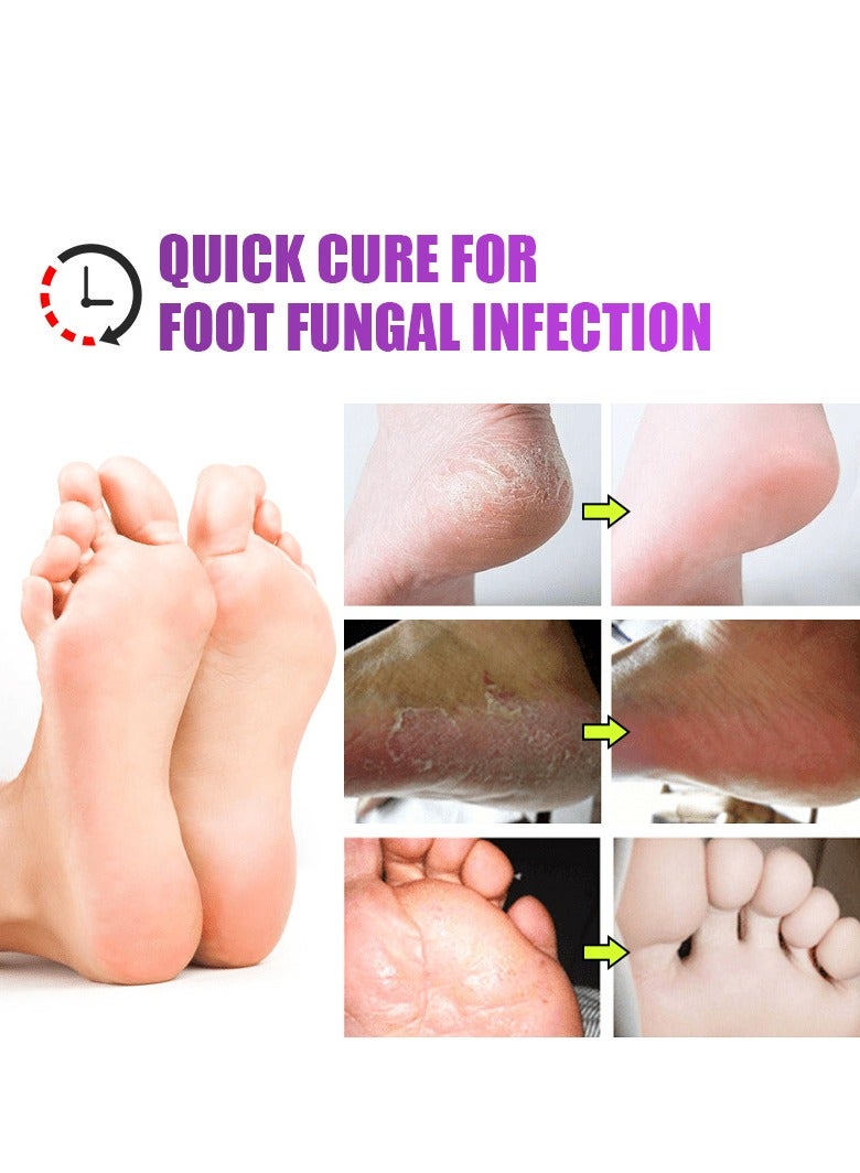 KanyeHB Foot Qi Plaster, Antibacterial Foot Deodorization Plaster, Prevent Foot Odor, Foot Care Cream Anti Fungi, Foot Skin External Application Cream - Image 4