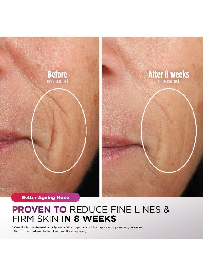 Shark CryoGlow Under Eye Cooling & LED Anti-Ageing & Blemish Repair Mask,Lilac Chill, FW312MEPL, 2 Years Warranty, Middle East Version - Image 4