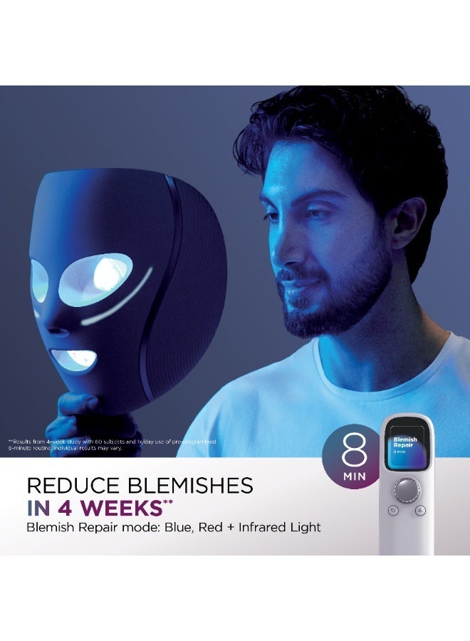 Shark CryoGlow Under Eye Cooling & LED Anti-Ageing & Blemish Repair Mask,Lilac Chill, FW312MEPL, 2 Years Warranty, Middle East Version - Image 5