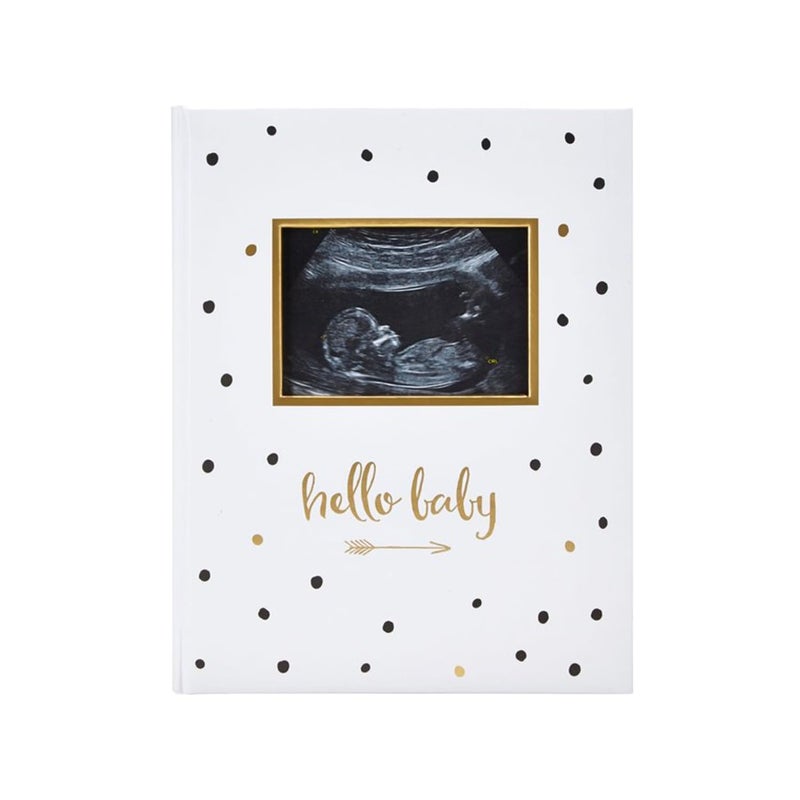 Pearhead Hello Baby First 5 Years Memory Book, Gender-Neutral Baby Keepsake for New and Expectant Parents, Pregnancy And Milestone Journal, Modern Minimalist Black and Gold Polka Dot - Image 1