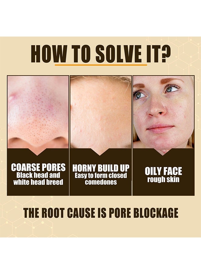 إيلهو مصل تكرير المسام بحمض اللاكتوبيونيك ، حمض اللاكتوبيونيك ، مصل شد المسام ، مصغر المسام النباتي للرجال والنساء بغض النظر عن العمر 30 مل - Image 3