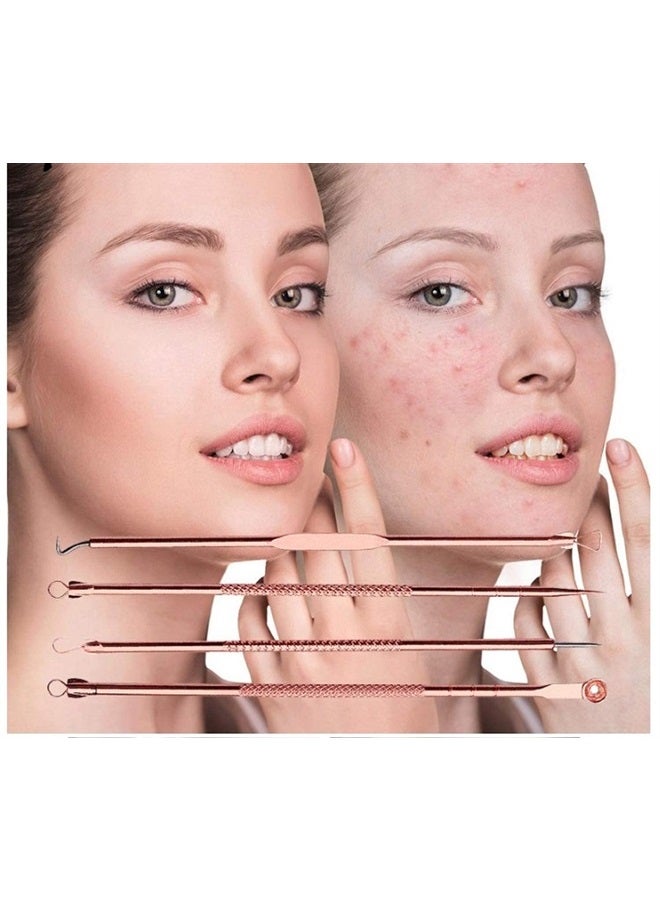 Mroobest Blackhead Remover Pimple Comedone Extractor Tool, Effective Acne Removal Kit, Treatment for Blemish, Whitehead Pimple Popping, Zit Removing for Nose & Face Skin, Best Electroplated 4 PCS w/case. - Image 2