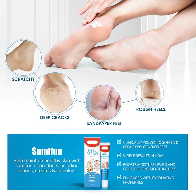 ويوبلز كريم ترميم القدمين، مرهم لعلاج تشققات الكعبين وجفاف القدمين، كريم ترميم الكعبين، كريم طبيعي لتهدئة القدمين، كريم ترميم الجلد المتشقق، إزالة الجلد الميت، كريم لتنعيم القدمين - Image 5