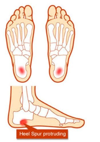 Pedag 201 Point Plus Heel Spur Cushion, Large (Men's 7-9) - Image 4
