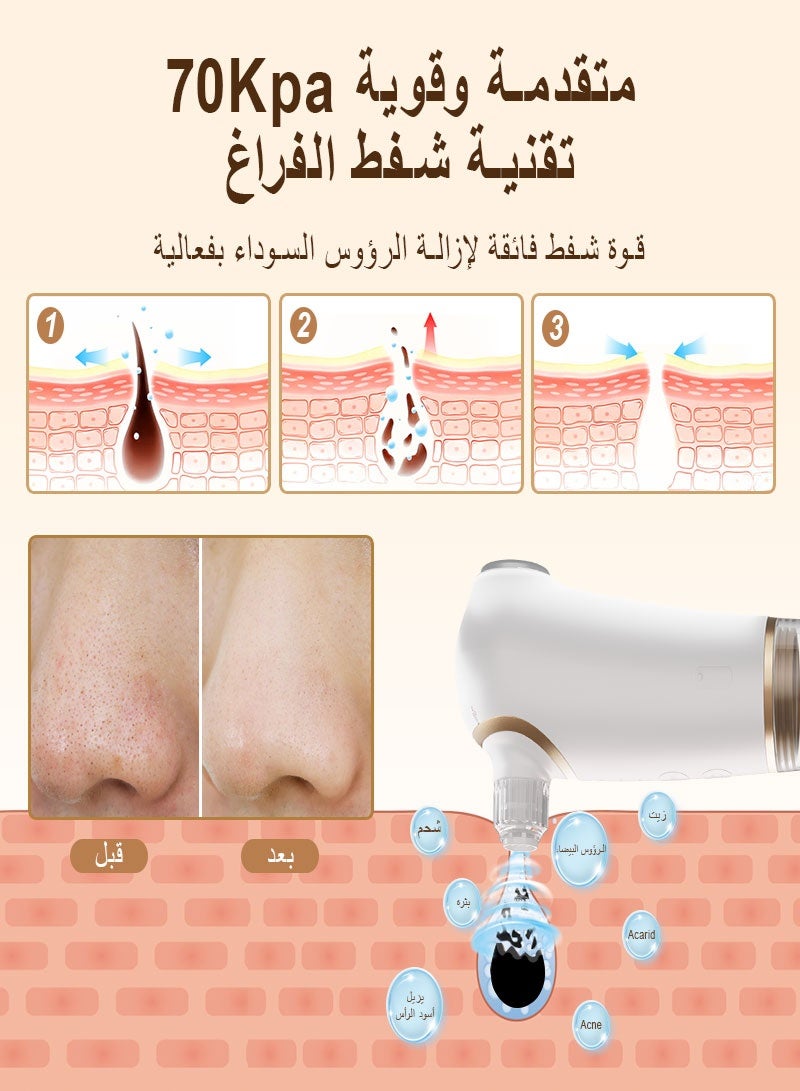 ميسا جهاز iMESA الكهربائي لشفط الرؤوس السوداء وتنظيف المسام، مزود بخاصية الكمادات الباردة والساخنة وتقنية "هيدرا فيشل" (هايدرا فيشل) التي تعتمد على دورة الماء والأكسجين؛ يتميز بـ 4 رؤوس شفط قابلة للتبديل و3 مستويات للشفط، وقابل للشحن عبر USB، ومناسب للاستخدام المنزلي وأثناء السفر للرجال والنساء. - Image 3