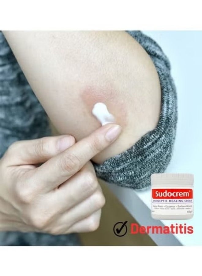 Sudocrem - Antiseptic Healing Cream to Protect Rash and Surface Wound for Baby 125G, Soothes, Heals, and Protects, Relief and Treatment of Diaper Rash, Developed to Provide Optimal Hydration and Moisturisation - Image 1