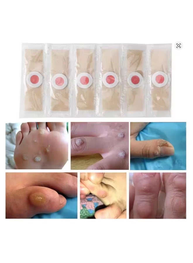 إيهوم 36 قطعة جص لإزالة مسامير القدمين، علاج مسامير القدمين، وسائد للعناية بالقدمين لتخفيف آلام مسامير القدمين - Image 4