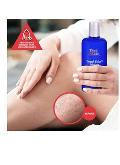 Tend Skin Tend Skin The Skin Care Solution For Unsightly Razor Bumps, Ingrown Hair And Razor Burns, 8 Fl Oz Bottle  - Image 2