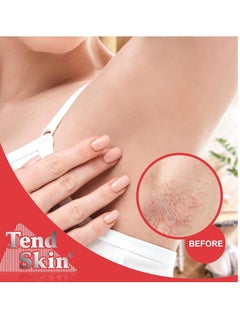 Tend Skin Tend Skin The Skin Care Solution For Unsightly Razor Bumps, Ingrown Hair And Razor Burns, 8 Fl Oz Bottle  - Image 3