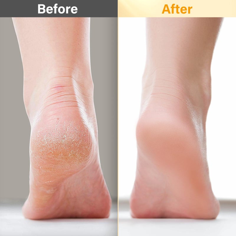 POP MODERN.C Pedicure Kit For Feet 5pcs Foot Spa Set For Christmas Birthday Valentine's Mother's Day Women Wife Girlfriend Gift Rose Lavender Foot Soak Salt Foot Callus Remover Gel Foot Rasp Foot Cream Foot Care - Image 5