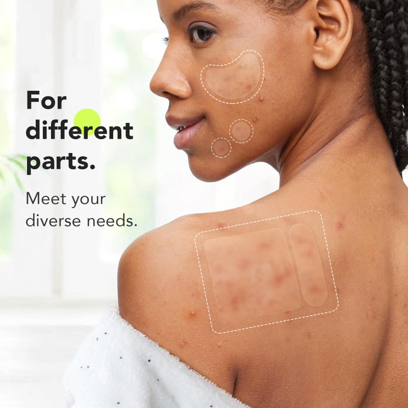 LitBear Large Pimple Patches (7 Sizes 112 Counts), Big Acne Patches, XL Hydrocolloid Bandages for Full Face, Forehead, Chin, Nose, Body, Back, Neck & Chest, Oval, Moon, Square hydrocolloid Patch - Image 3