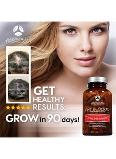 Advanced Trichology Dht Blocker Hair Growth Supplement For Genetic Thinning For Men And Women ; Approved* By American Hair Loss Association ; Guaranteed Backed By 20 Years Of Experience In Hair Loss Treatment Clinics  - Image 4