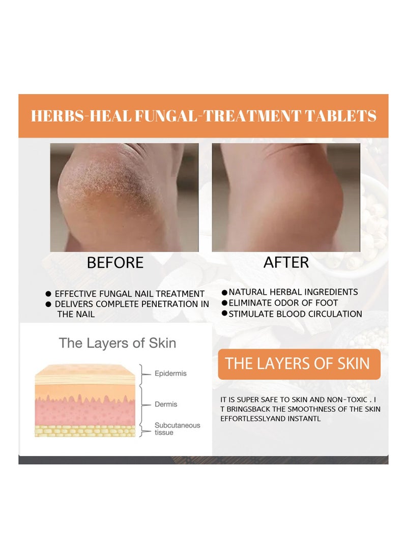 EELHOE - Anti-Fungal Peeling Foot Soak 10-Pieces - Image 1