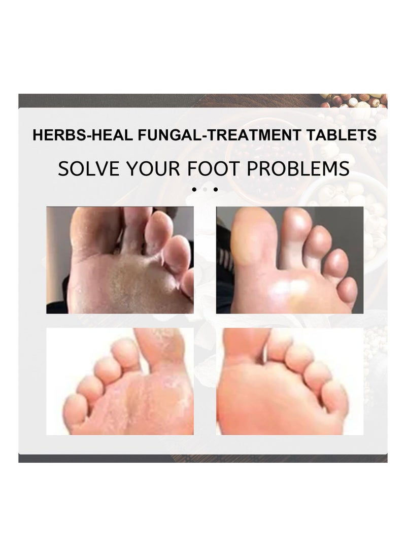 EELHOE - Anti-Fungal Peeling Foot Soak 10-Pieces - Image 1