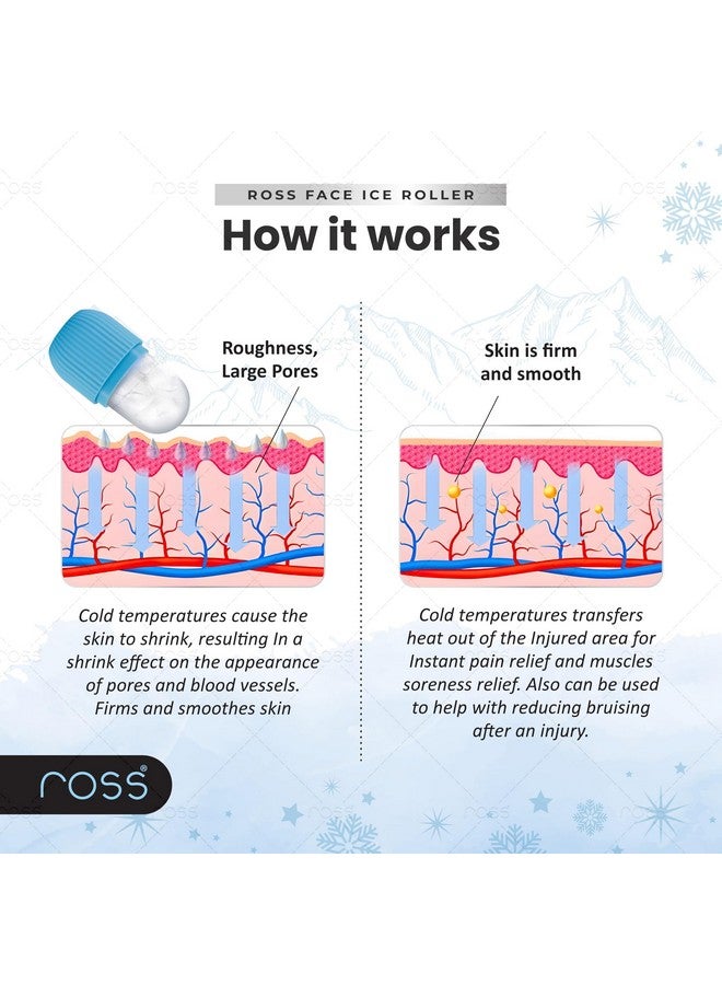 ROSS Ice Roller For Face, Neck And Body | For Puffy Eyes And Facial Skin Care, Ice Facial Cube (Random Color) - Image 4