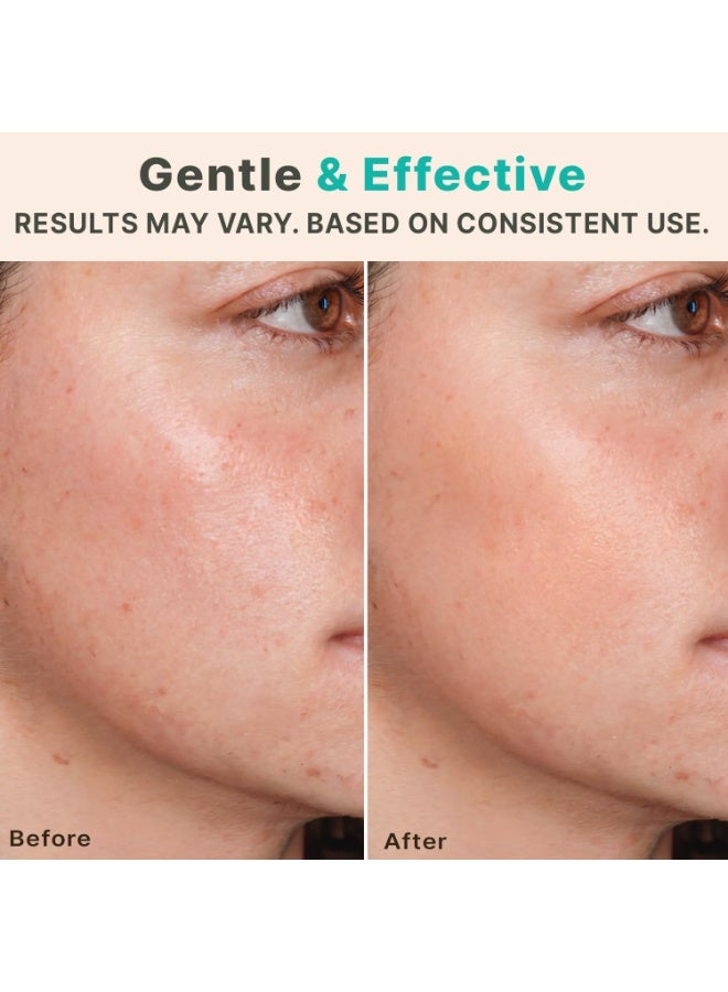 GoldenLike  بكرة الجلد للوجه والجسم وفروة الرأس، بكرة الوخز بالإبر الدقيقة لعلاج تجاعيد الوجه وتساقط الشعر للرجال والنساء - Image 2