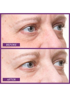 PRAI PRAI Beauty Ageless Eye D-Crease, Anti-Aging Eye Cream for Instantly Ageless-Looking Eyes, Under Eye Cream  - Image 3