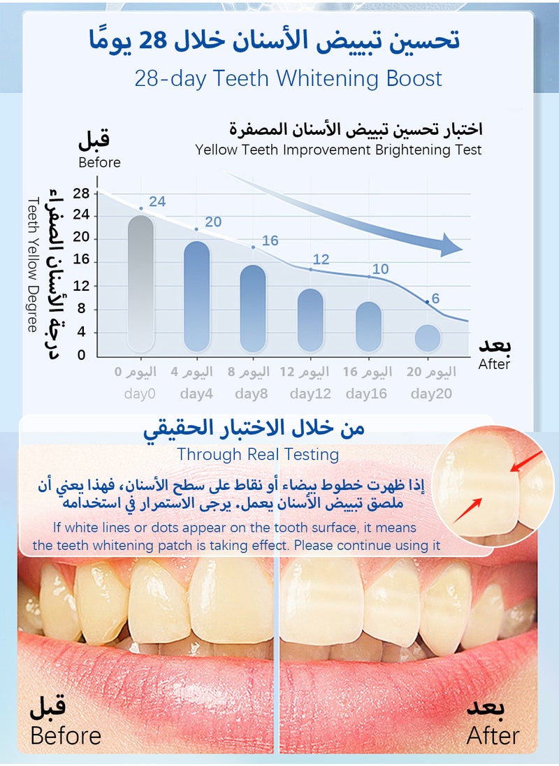 أل آند وين شرائط تبييض الأسنان مع 10% من زيت جوز الهند وزيت جوز الهند، آمنة 100% ولا تترك بقايا، تصحيح الألوان الفعال المحمول مع الإصدار 34 الأرجواني، مجموعة تبييض الأسنان للبالغين 7 قطع، 14 شريطًا  - Image 4