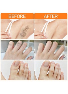 JoyPretty 60s Upper Lip Hair Removal Cream,Hair Removal Cream for Upper Lip Face & Chin Fast & Gentle with 30X Delay Hair Growth Moisturizing Hair Removal with Almond Oil & Aloe Vera Extract 20g  - Image 5