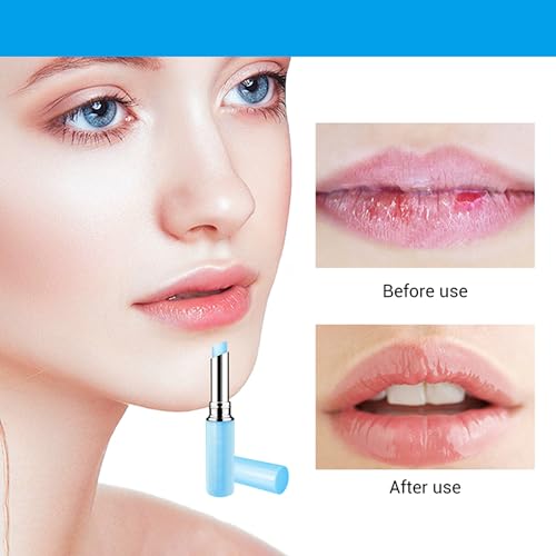 MIESCHER Hyaluronic Acid Lip Balm, Long-lasting Moisturizing Lips, Lip Care Daily Use Lip Balm (New Packing) (Hyaluronic acid) - Image 3