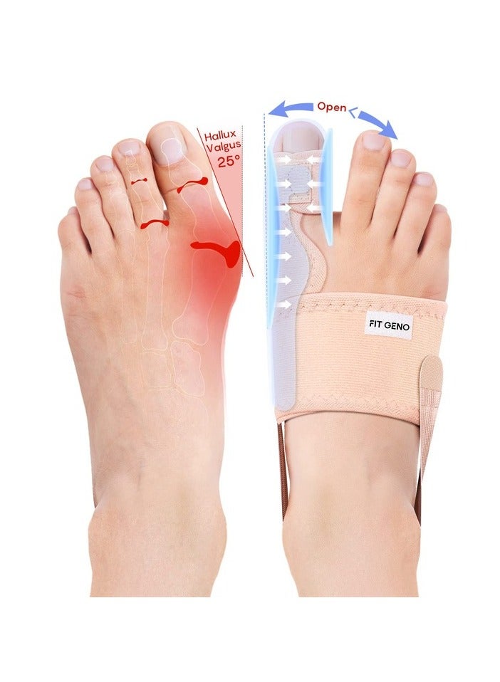 Toe Rectifier, Hallux Valgus Women's Big Mother Orthosis, Foot Bone Protruding Correction Big Toe Artifact, 16.5*14.5 * 5cm, Free Size - Image 1