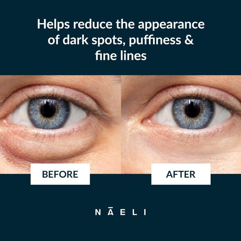 NAELI Eye Cream for Dark Circles, Puffiness & Wrinkles with Anti Aging Apple Stem Cell & Peptide Complex - Reduces Fine Lines, Diminishes Bags & Restores Under Eye, 1.4 oz - Image 3