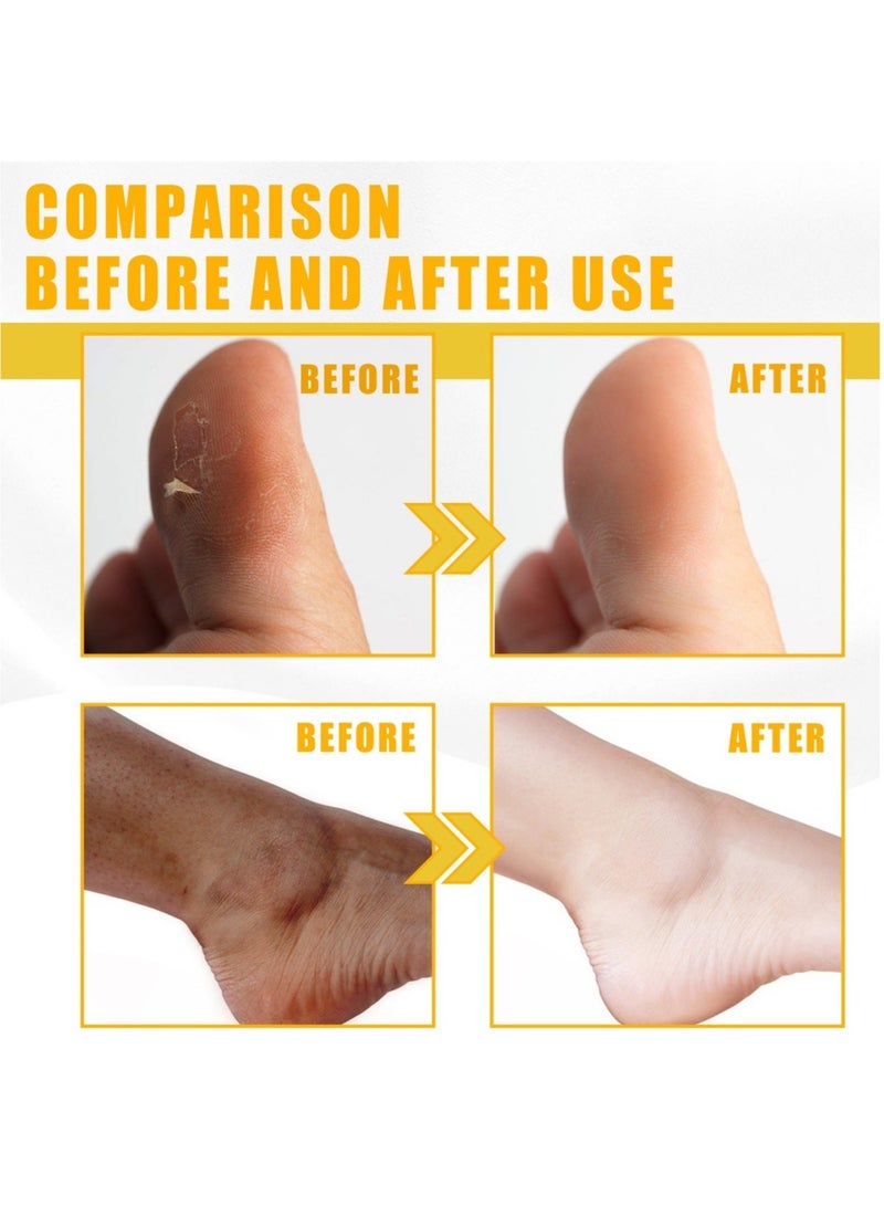 100ml Super Strength Yellow Peeling Oil Exfoliating Dark Skin for Body, Yellow Peeling Oil Body Whitening Skins, Butter Peeling Lightening Brighten Complexion for Cleansing and Moisturizing  - Image 3