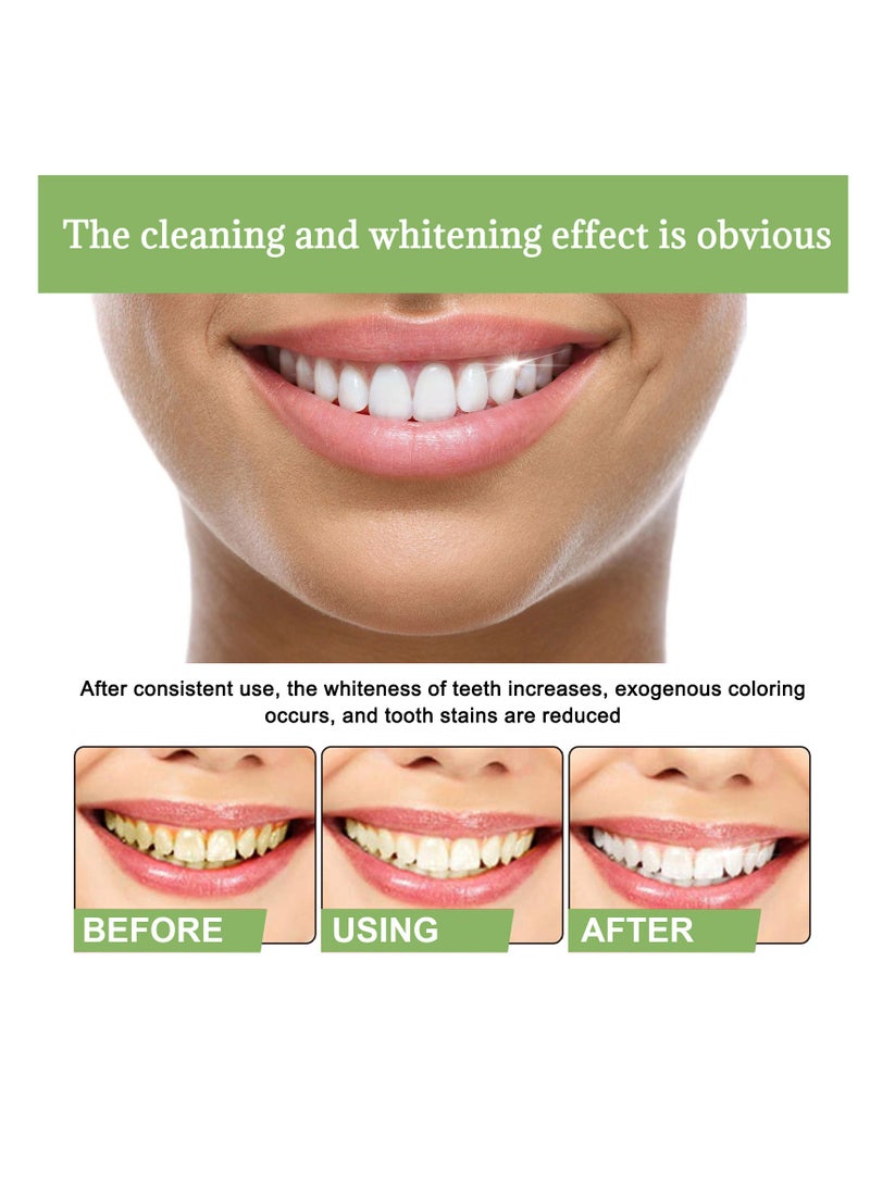 إيلهو 10 قطعة أمبولة مجموعة جوهر الأسنان إزالة حجر الأسنان تبييض الأسنان ، والقضاء على رائحة الفم الكريهة - Image 3
