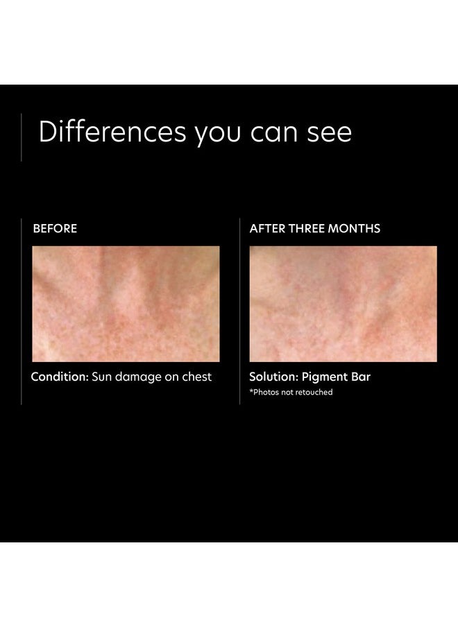 PCA SKIN Pigment Bar Face & Body Cleansing Soap With Azelaic & Kojic Acids Brightens Dark Spots Discoloration & Uneven Skin Tone (3.2 Oz)  - Image 5