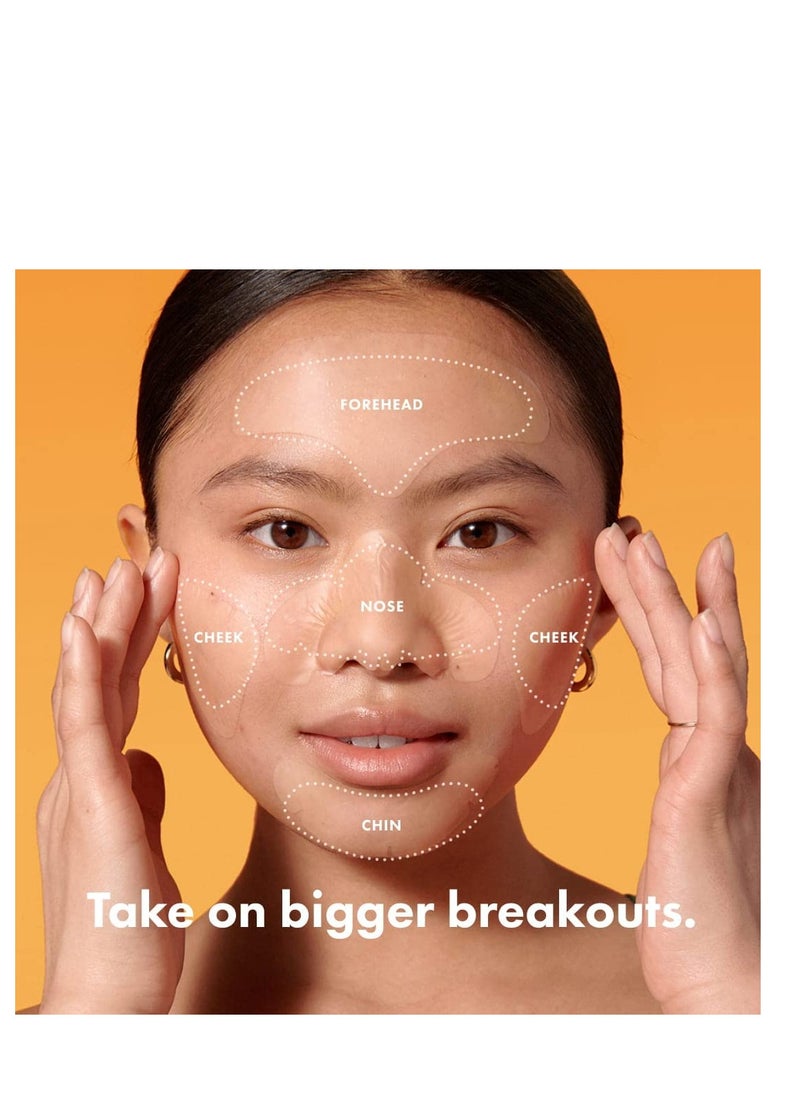 Mighty Patch Mighty Patch™ Face Patch from Hero Cosmetics - XL Hydrocolloid Face Mask for Acne, 5 Large Pimple Patches for Zit Breakouts on Nose, Chin, Forehead & Cheeks - Vegan-Friendly (1 Count)  - Image 2