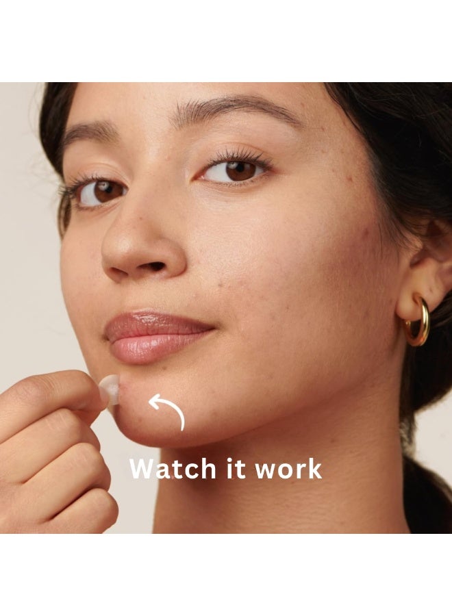 أريكسا لصقات حب الشباب الهيدروكولويدية من أريكسا لتغطية البثور والبقع في الوجه والبشرة، صديقة للنباتيين ولم يتم اختبارها على الحيوانات (72 لصقة) - Image 5