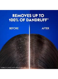 Head & Shoulders Menthol Refresh Anti-Dandruff Shampoo For Cools and Energizes Scalp 600ml  - Image 2