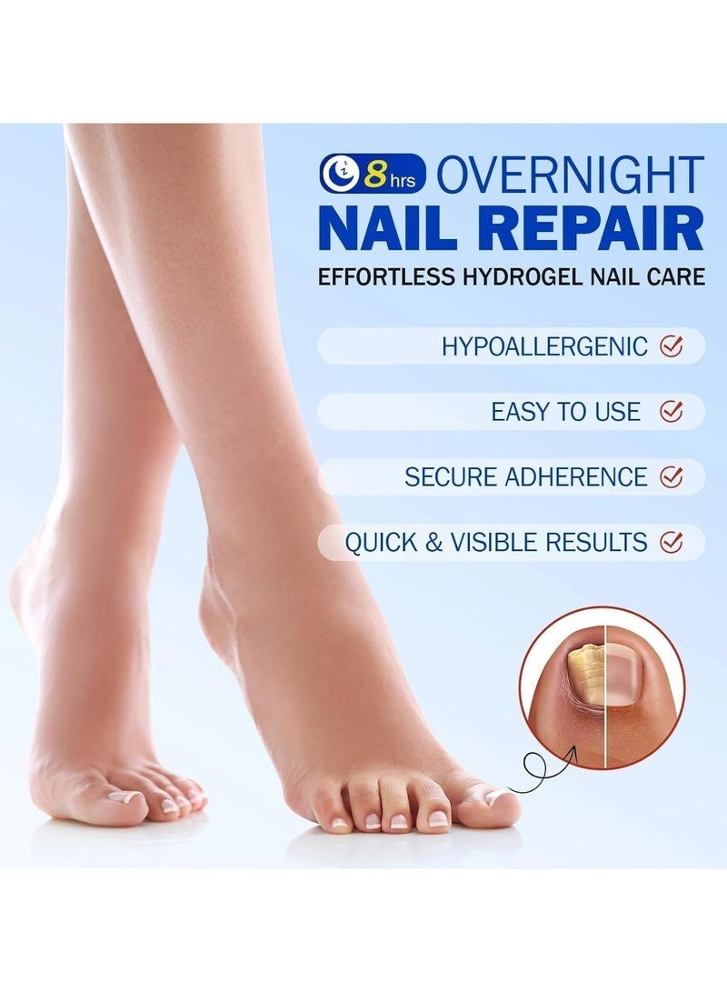 ATRJSZ Fungal Nail Repair Patches – Effective Care Solution for Healthy, Strong Toenails. Easy-to-Use, Fast-Acting & Long-Lasting Results - Image 2