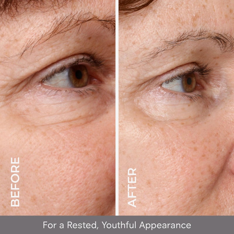 COSMEDIX Under Eye Serum for Dark Circles & Puffiness, Opti Crystal - Lifting & Firming Liquid Serum for Fine Lines & Wrinkles - Brightening, Moisturizing, & Hydrating Anti Aging Eye Puffy Bags Serum - Image 3