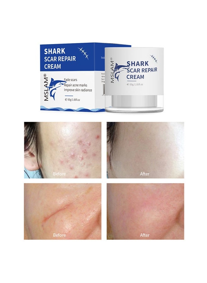 MSLAM Scar Repair Cream， Facial And Body Scar Repair，Lightening Scars And Acne Marks， Using Natural Ingredients (30g) - Image 1