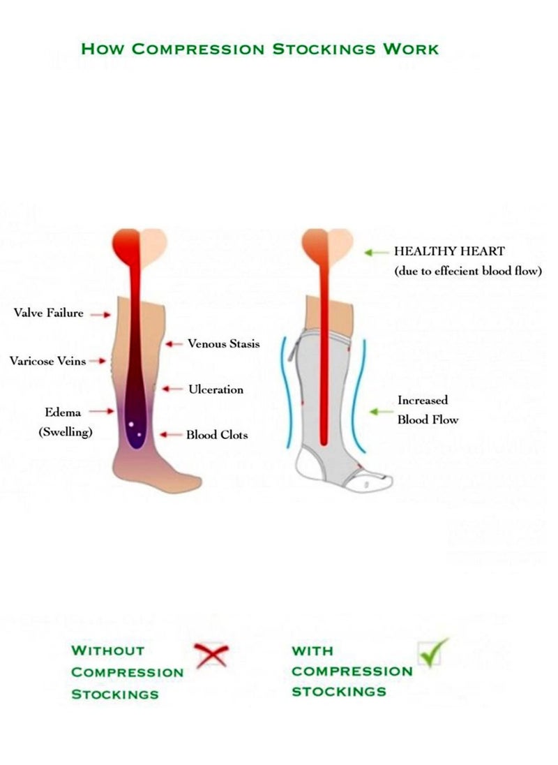 Venosan - Venosan 7000 Below Knee Class II Skin Tone VM72005, Size XX-Large - Image 1