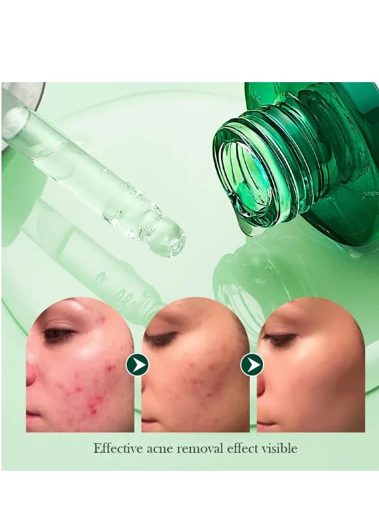 SADOER SADOER Tea Tree Acnes Oil Control Face Serum  - Image 3