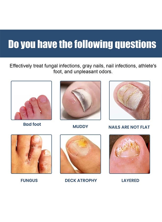ساوث مون رذاذ القدم الرمادي للأظافر - تركيبة لطيفة وفريدة من نوعها ، تركيبة مضادة للفطريات ومزيلة للروائح الكريهة للقدمين ، مهدئة ومنعشة للقدمين ، علاج فطريات أظافر القدم 30 مل - Image 2