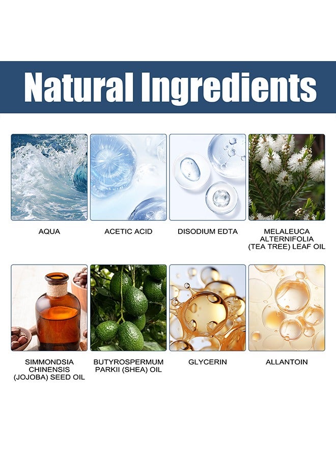 ساوث مون رذاذ القدم الرمادي للأظافر - تركيبة لطيفة وفريدة من نوعها ، تركيبة مضادة للفطريات ومزيلة للروائح الكريهة للقدمين ، مهدئة ومنعشة للقدمين ، علاج فطريات أظافر القدم 30 مل - Image 3