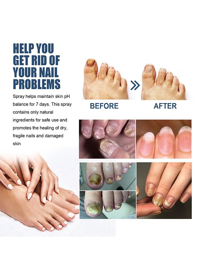 ساوث مون رذاذ القدم الرمادي للأظافر - تركيبة لطيفة وفريدة من نوعها ، تركيبة مضادة للفطريات ومزيلة للروائح الكريهة للقدمين ، مهدئة ومنعشة للقدمين ، علاج فطريات أظافر القدم 30 مل - Image 4