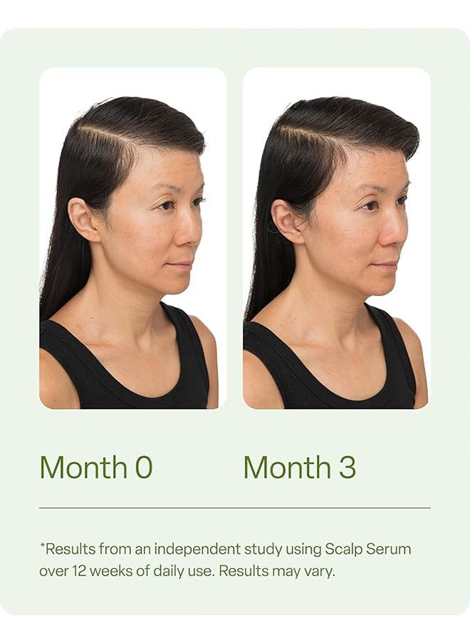 DiVi - Scalp Serum with Revitalize and Detoxify 30ml, Improves Appearance of Thin Hair, Nourishes Hair Follicles, Detoxifies Product Build Up for Man and Women, Promotes Healthy Scalp and Fuller - Image 1