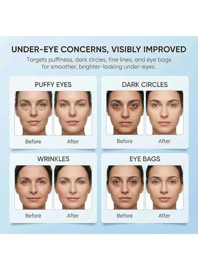 إيلهو أقنعة العين – 30 زوجًا | أقنعة تحت العين للدوائر السوداء والانتفاخ والخطوط الدقيقة | تحتوي على كولاجين نباتي، حمض الهيالورونيك، النياسيناميد، فيتامين E | ترطيب، مضادة للشيخوخة - Image 5
