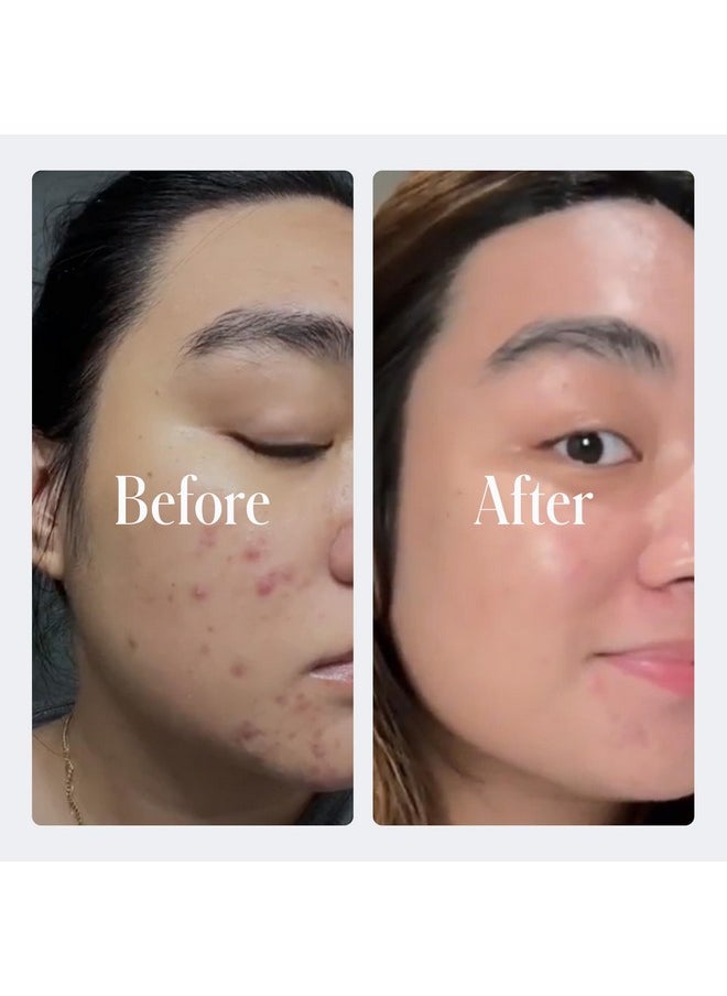 Geologie - 2% Salicylic Acid Face Wash Cleans Exfoliates Clears Skin Without Drying Leaving You Fresh Invigorated Effective For Acne Oily Skin Citrusy Bergamot + Juniper Scent - Image 1