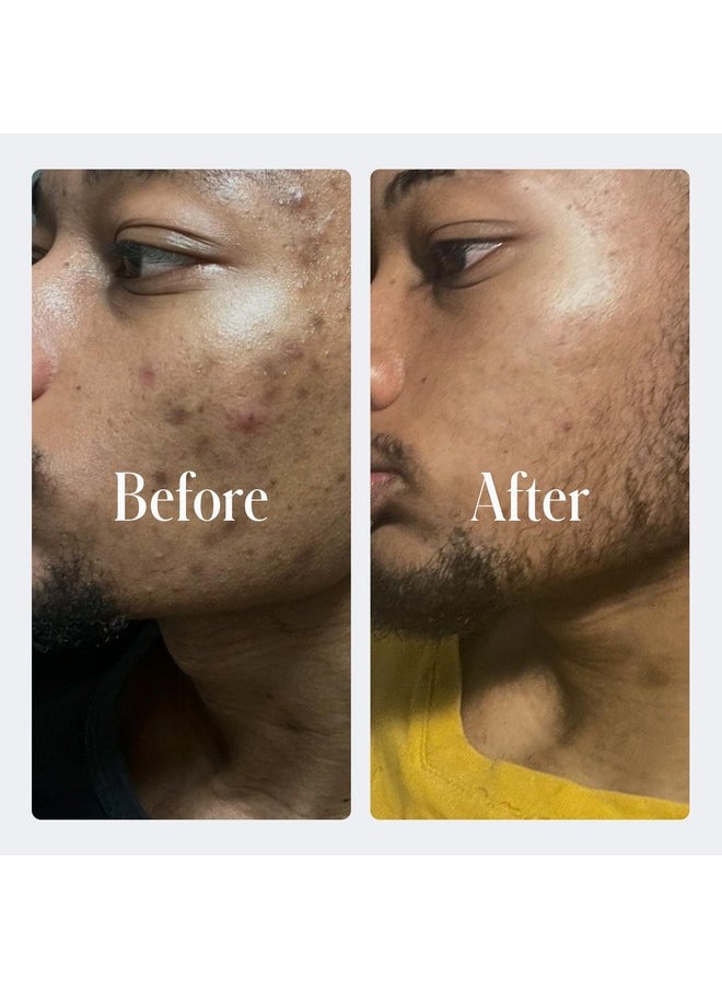 Geologie - 2% Salicylic Acid Face Wash Cleans Exfoliates Clears Skin Without Drying Leaving You Fresh Invigorated Effective For Acne Oily Skin Citrusy Bergamot + Juniper Scent - Image 1