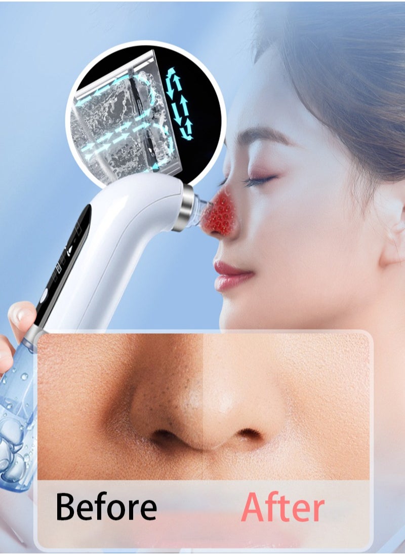 Joshberg Blackhead Remover Pore Vacuum Facial Cleaner 6 Suctions USB Rechargeable Facial Cleaning Tools  - Image 4