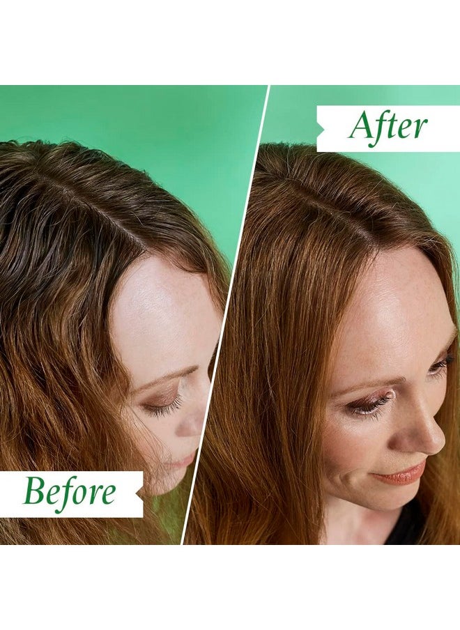 Philip Kingsley - Flaky Scalp Shampoo For Flaky Dry Oily Scalps Cleansing Scalp Care Hair Products Soothing Soothes And Calms 8.45 Oz. - Image 1