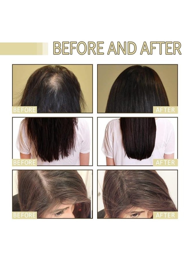 إيلهو زيت نمو الشعر النباتي الطبيعي بسعة 120 مل، زيت الشعر النباتي، زيت نمو الشعر الطبيعي، زيت الروزماري العضوي لنمو الشعر، زيت نمو الشعر - Image 4