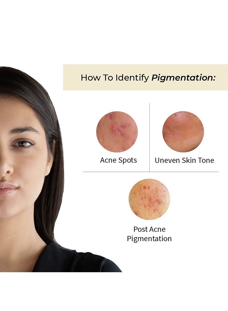 Vedix Face Serum, Customised Ayurvedic Avas Spot Correcting Face Serum for Dark Spots & Pigmentation With Vitamin A + Vitamin C + Onion + Lodhra + Bakuchi - 20 ml - Image 5