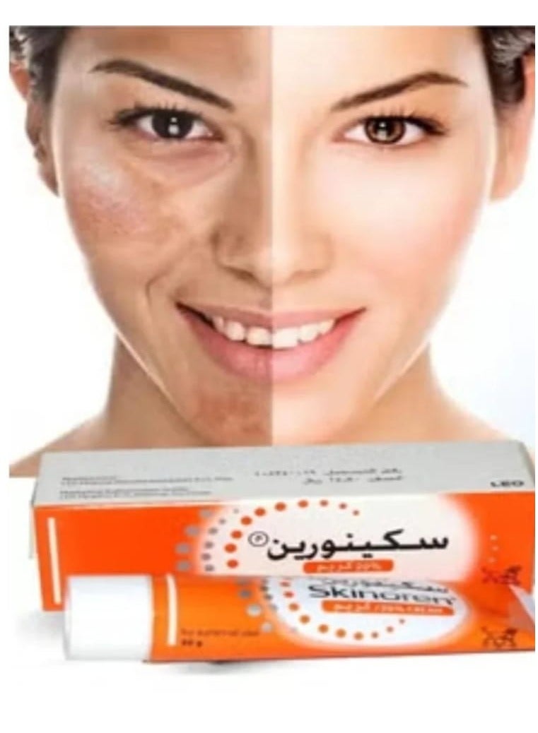 Skinoren Acne Treatment Cream