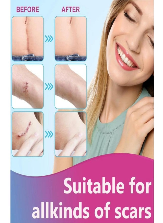 Bokor Silicone Scar Sheets, Silicone Scar Tape for Surgical Scars, Scar Removal Patches with Medical Grade Treatment (1.5M - Image 2